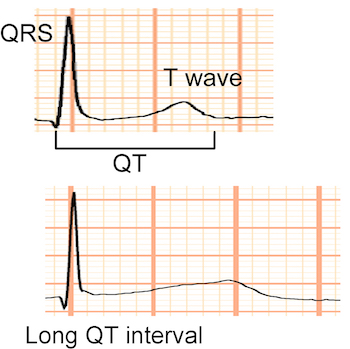 Tristani Lab QT Figure Graphic