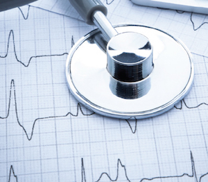 Tristani Lab Stethoscope ECG Graphic