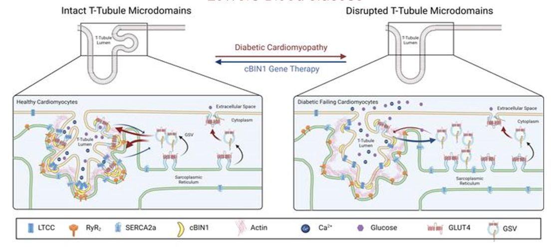 <h3>Cardiac Gene Therapy Treats Diabetic Cardiomyopathy and Lowers  Blood Glucose</h3>