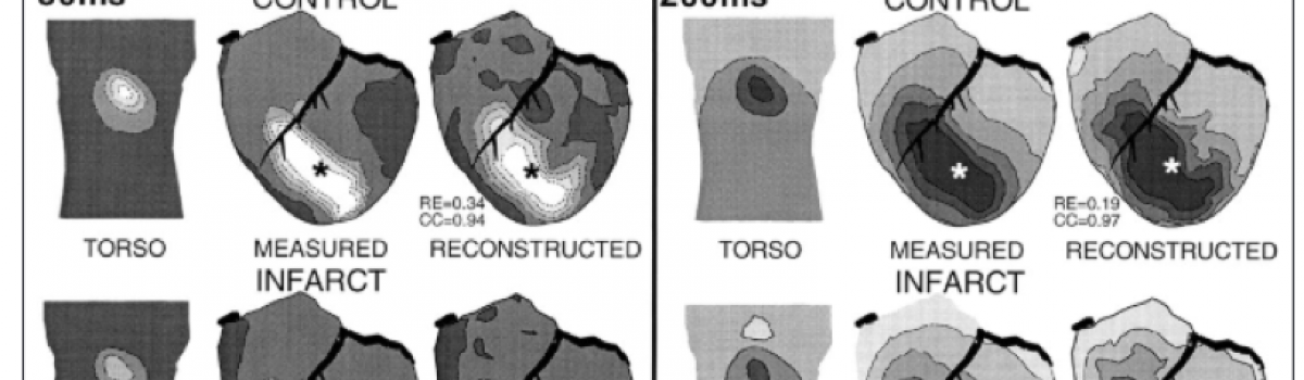 ECG Imaging of electrophysiologically abnormal substrates in infarcted hearts