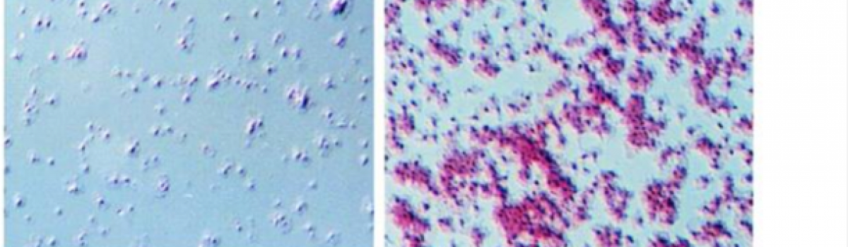 Human Platelets translate messenger RNAs