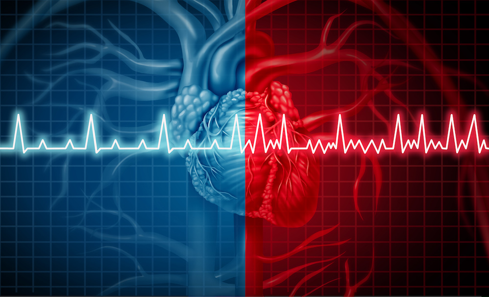 Red and Blue Human Heart EKG - What is an EKG Test Blog Graphic