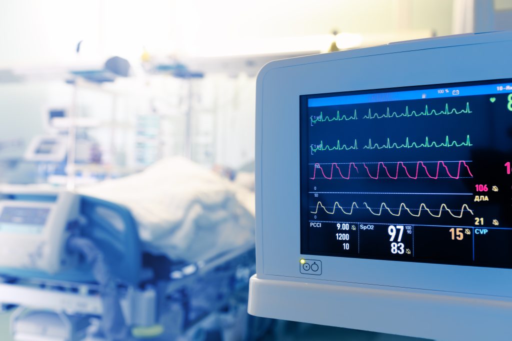 Closeup of EKG Machine with Patient Who Has Cardiac Arrhythmia in the Background in Hospital Bed