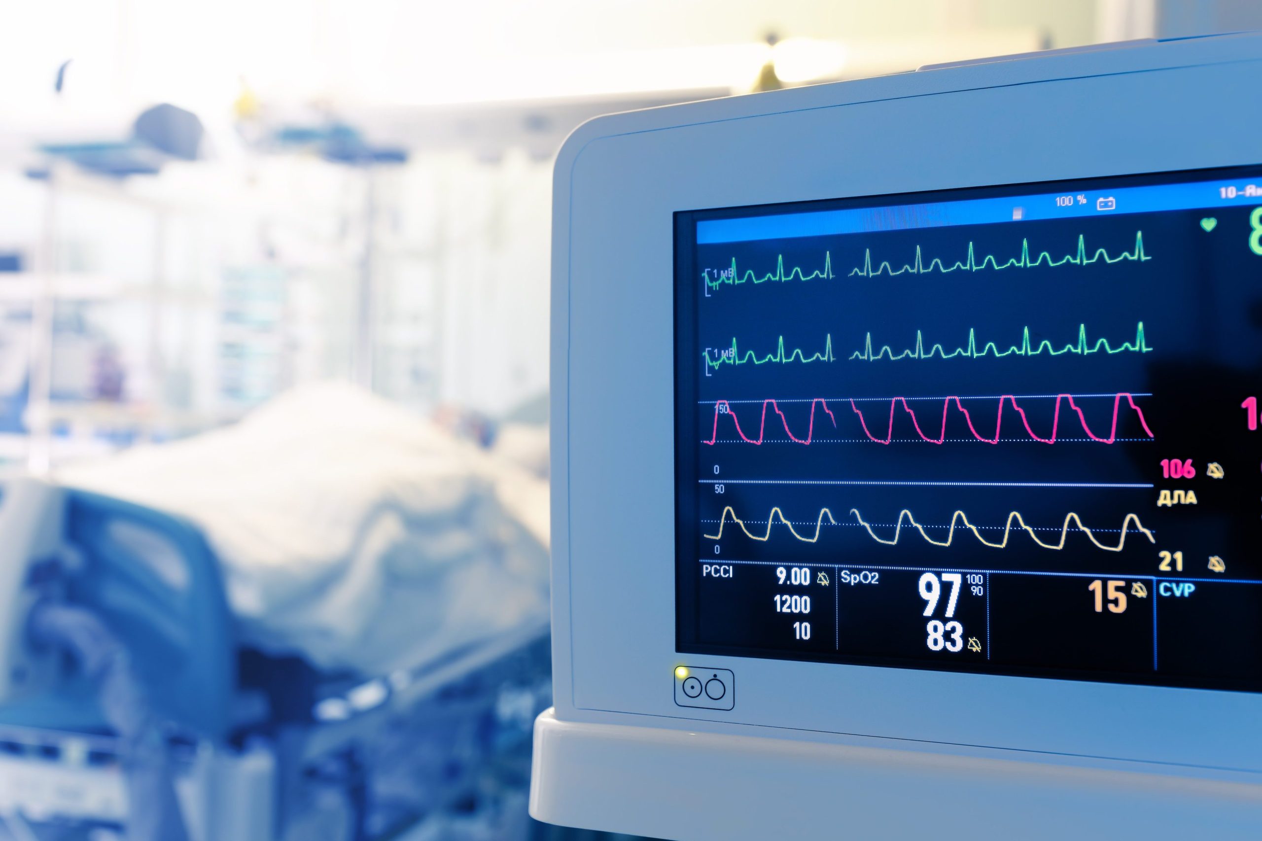 Closeup of EKG Machine with Patient Who Has Cardiac Arrhythmia in the Background in Hospital Bed