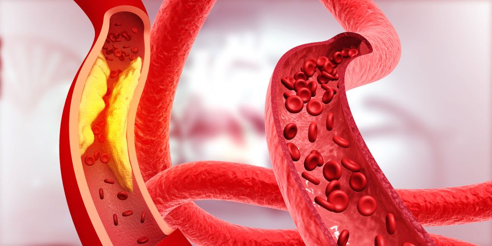 Graphic of Blood Cells in Vein