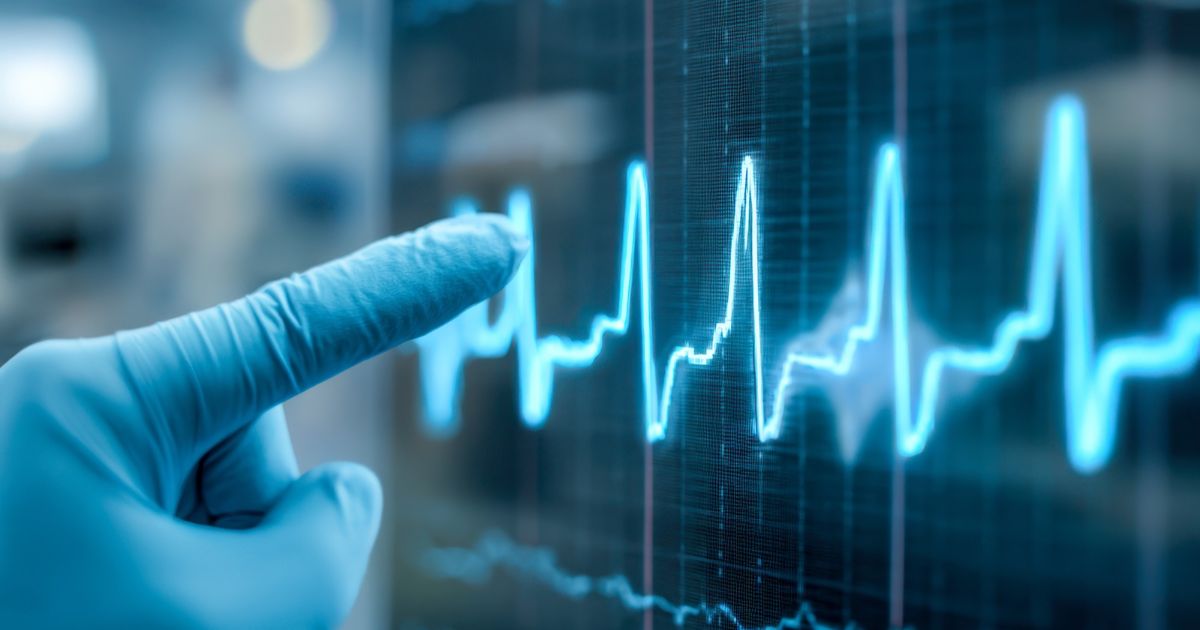 Why Changes in Heart Ion Channels Can Cause Rhythm Problems
