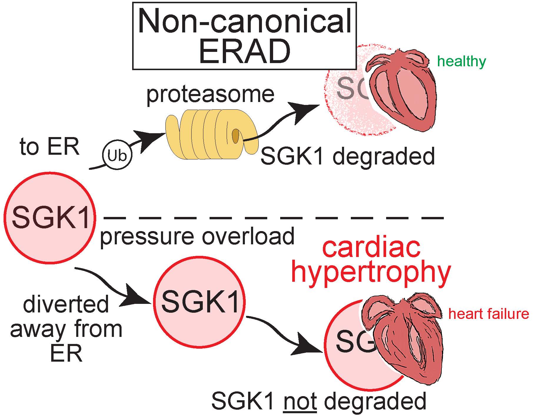 Diagram comparing healthy and failing hearts: In healthy hearts, SGK1 is degraded by the proteasome; under cardiac hypertrophy, SGK1 is not degraded, leading to heart failure. Arrows show the pathways.