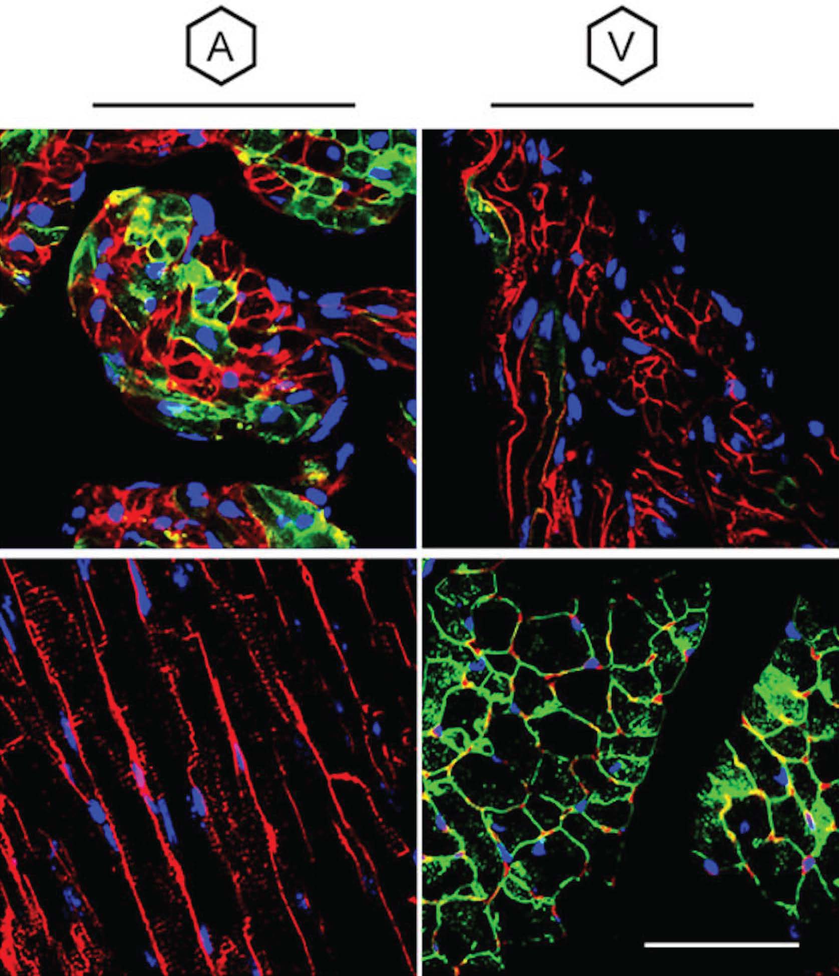 Four panels show fluorescent-stained tissue images under columns labeled A and V. Red, green, and blue colors highlight different cell structures and patterns in each sample.
