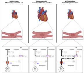 Diagram compares metabolic pathways in healthy, hypertrophic, and MCT1-inhibited hearts, showing heart illustrations above detailed cellular diagrams of glucose, pyruvate, and lactate metabolism in each condition.