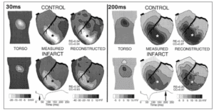 Two grids compare heart activity in control and infarcted tissues at 30ms and 200ms. Each grid shows torso, measured, and reconstructed maps, with color gradients representing electrical potentials over time.