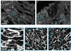 Black and white microscopic images show tissue structure comparisons. Enlarged insets highlight distinct morphological details, with blue boxes and arrows indicating areas of interest for closer examination.