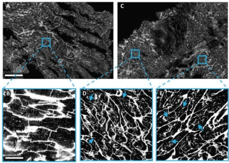 Black and white microscopic images show tissue structure comparisons. Enlarged insets highlight distinct morphological details, with blue boxes and arrows indicating areas of interest for closer examination.