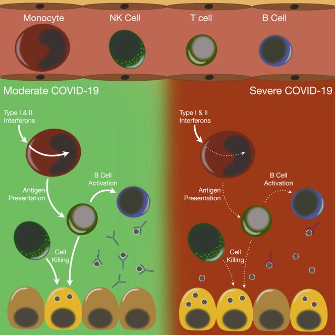 Infographic showing immune cell responses in moderate vs. severe COVID-19: moderate cases have effective interferon response and antigen presentation, while severe cases show impaired responses and less effective cell killing.